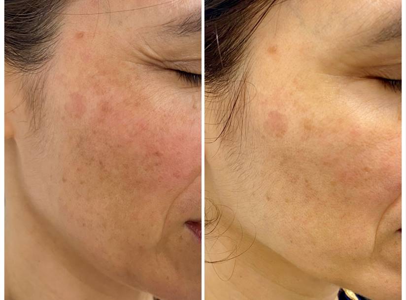 ISDIN Melaclear Advanced Serum