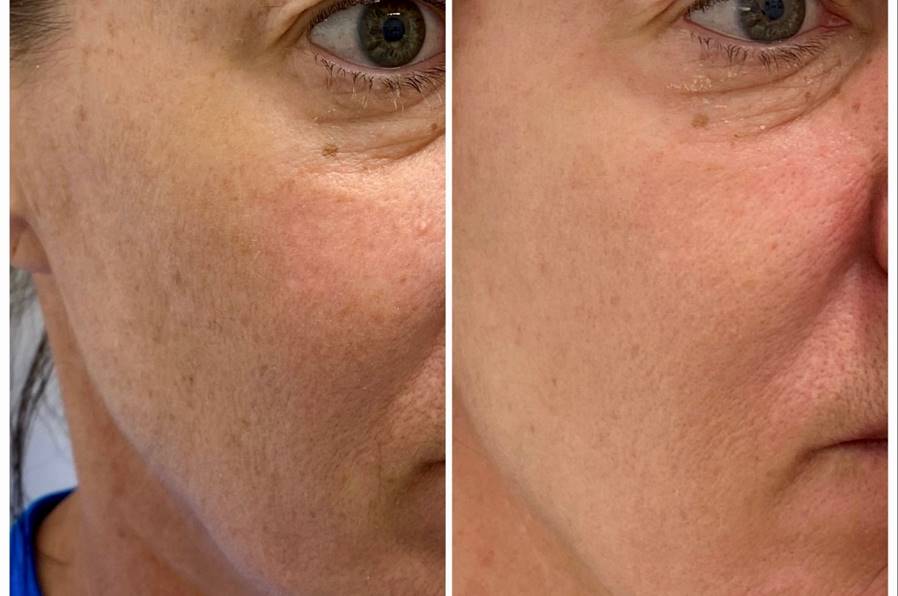 ISDIN Melaclear Advanced Serum