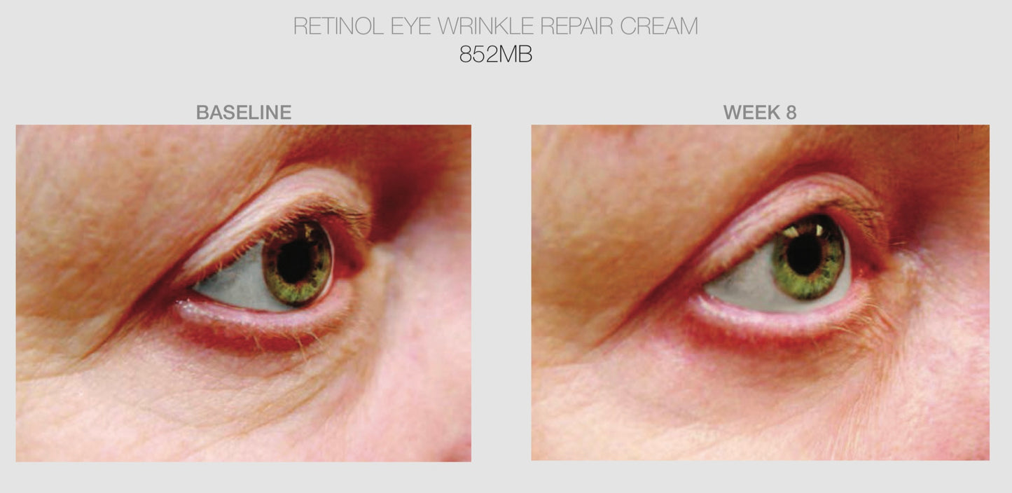 DI Retinol Rejuvenation Night Eye Cream