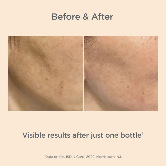 ISDIN Melaclear Advanced Serum