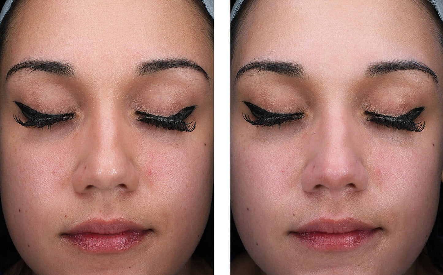 Before and after application