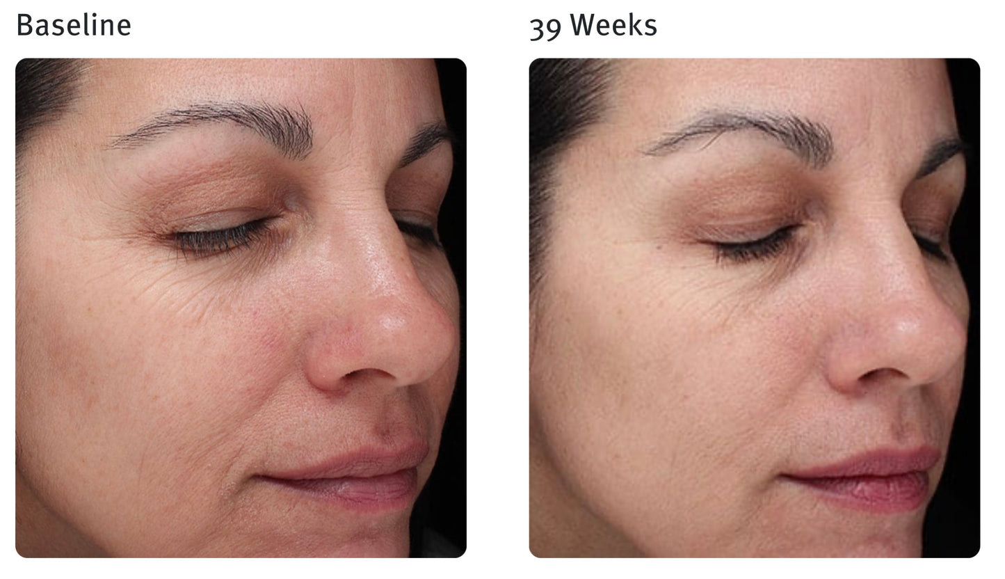 Epionce Sensitive OR Dry Skin Renewal Facial Cream