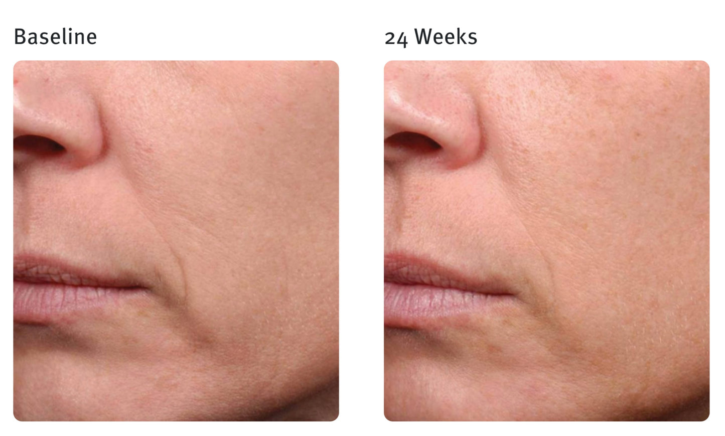 Epionce Sensitive OR Dry Skin Renewal Facial Cream
