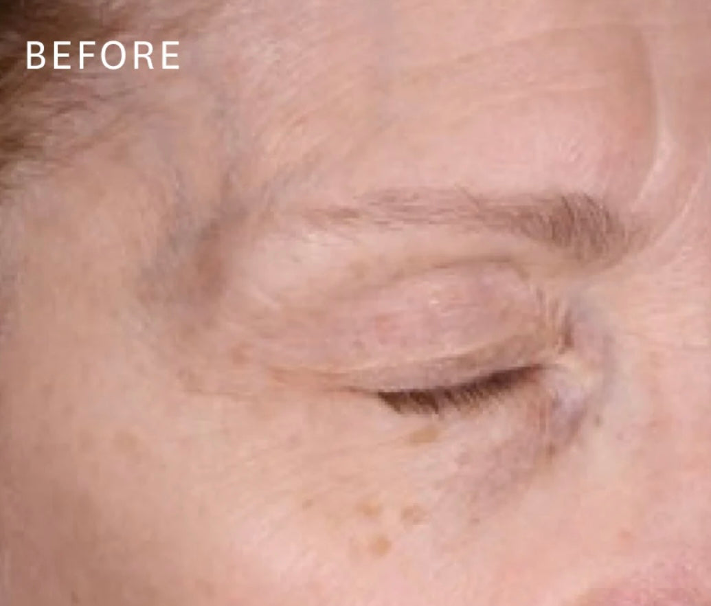12 week trial : before