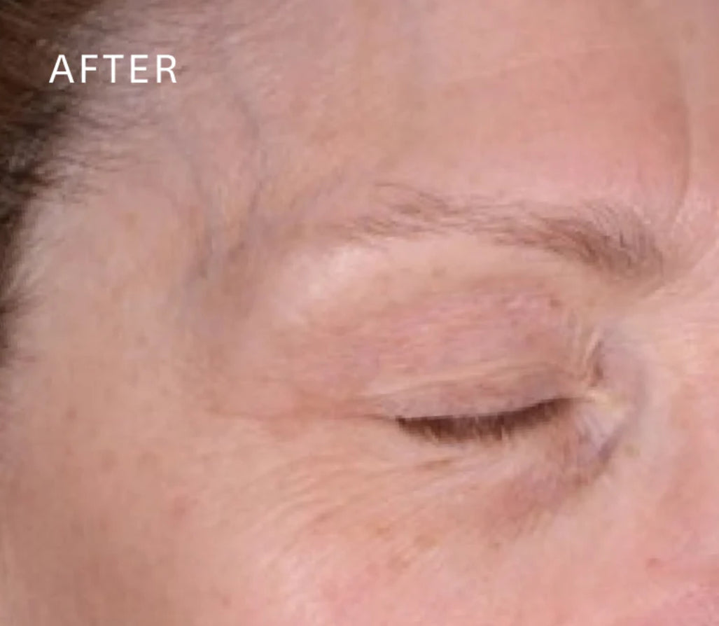 12 week trial : after