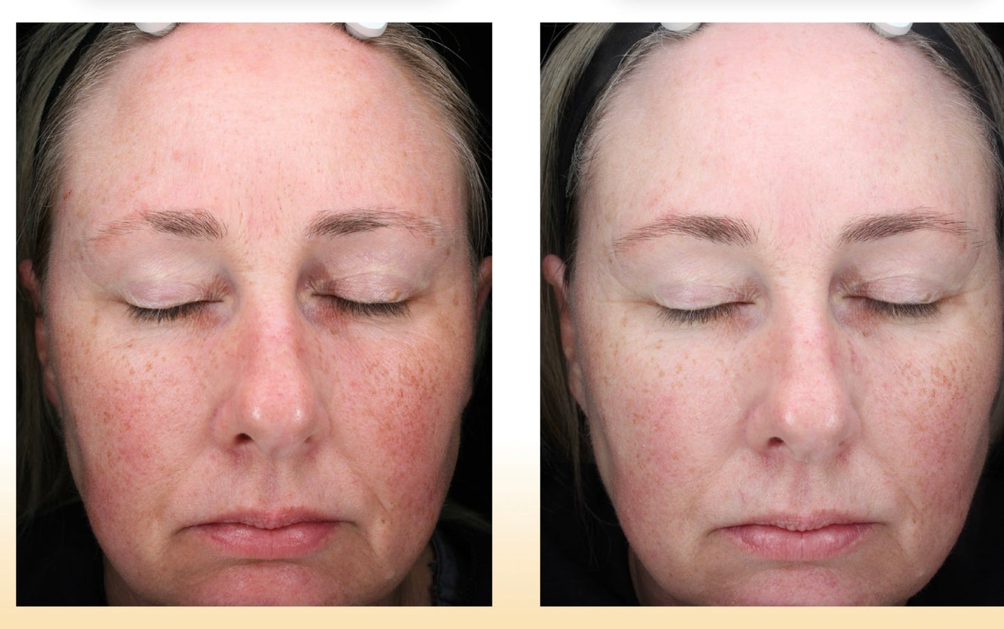 C-RADICAL Defense Antioxidant Serum