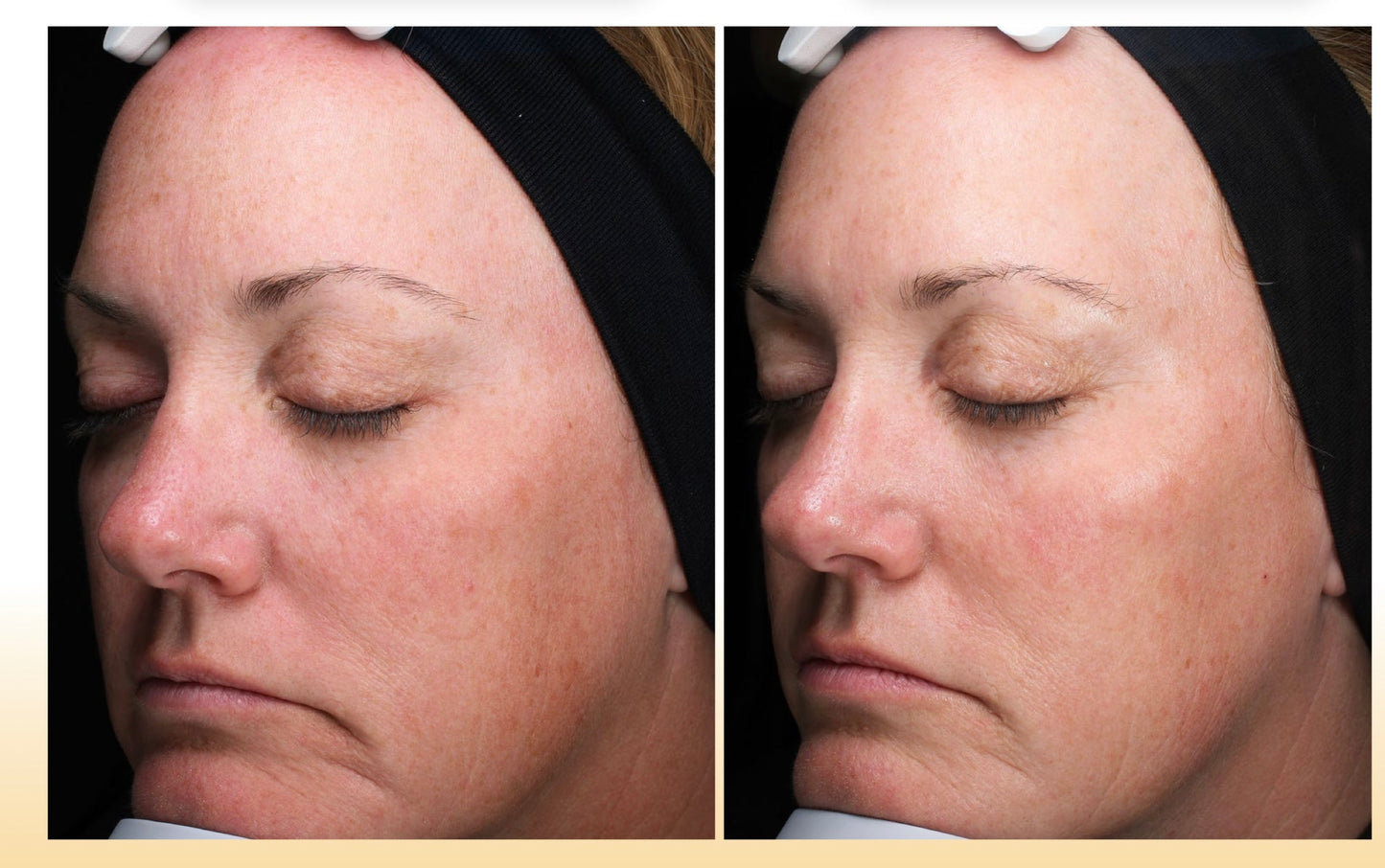 C-RADICAL Defense Antioxidant Serum