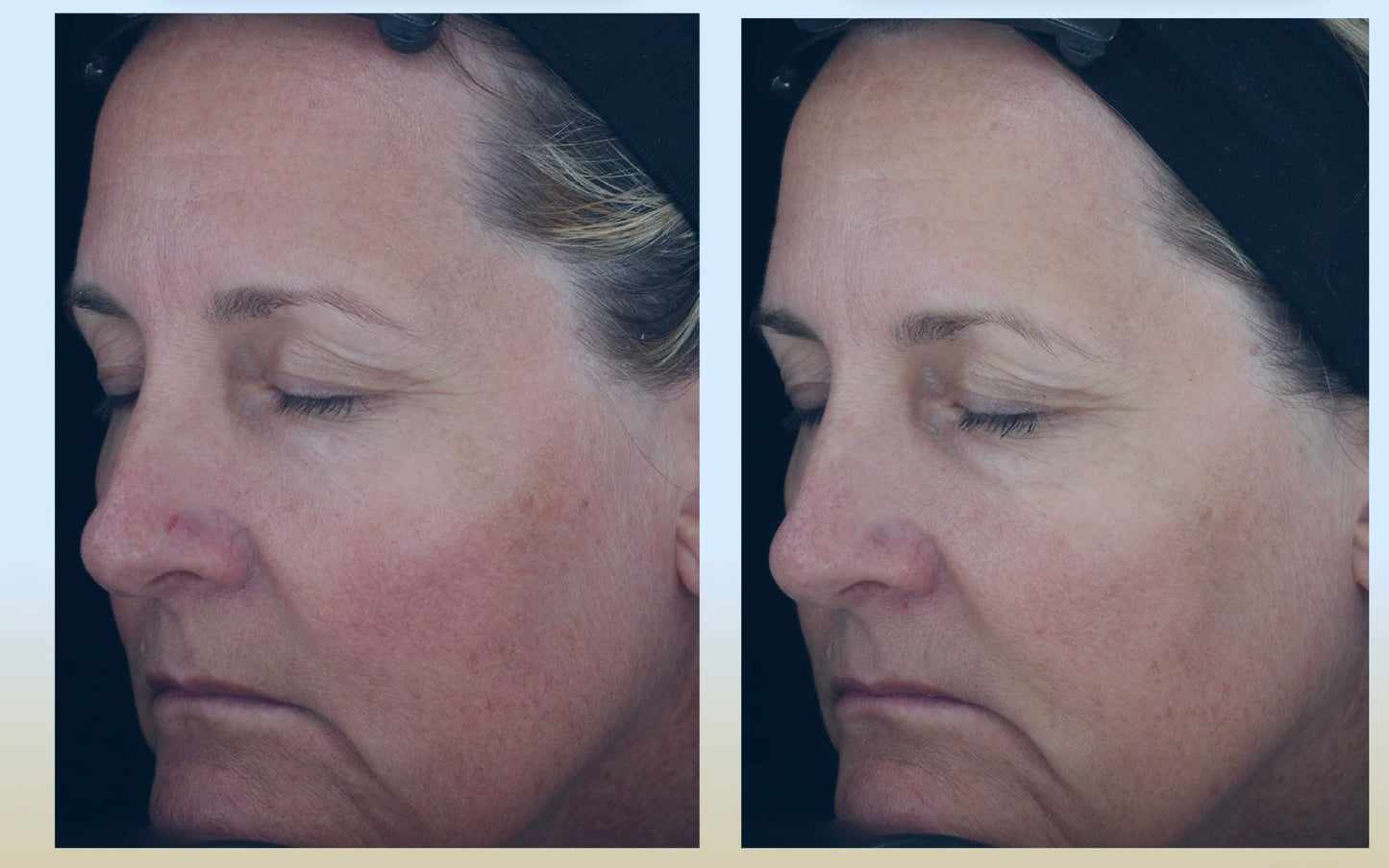 C-RADICAL Defense Antioxidant Serum
