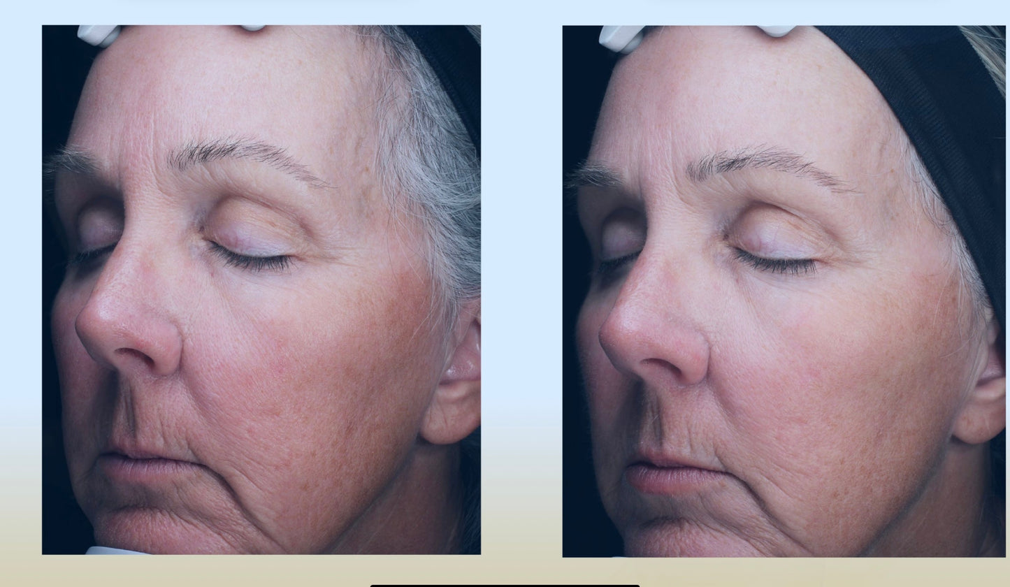 C-RADICAL Defense Antioxidant Serum