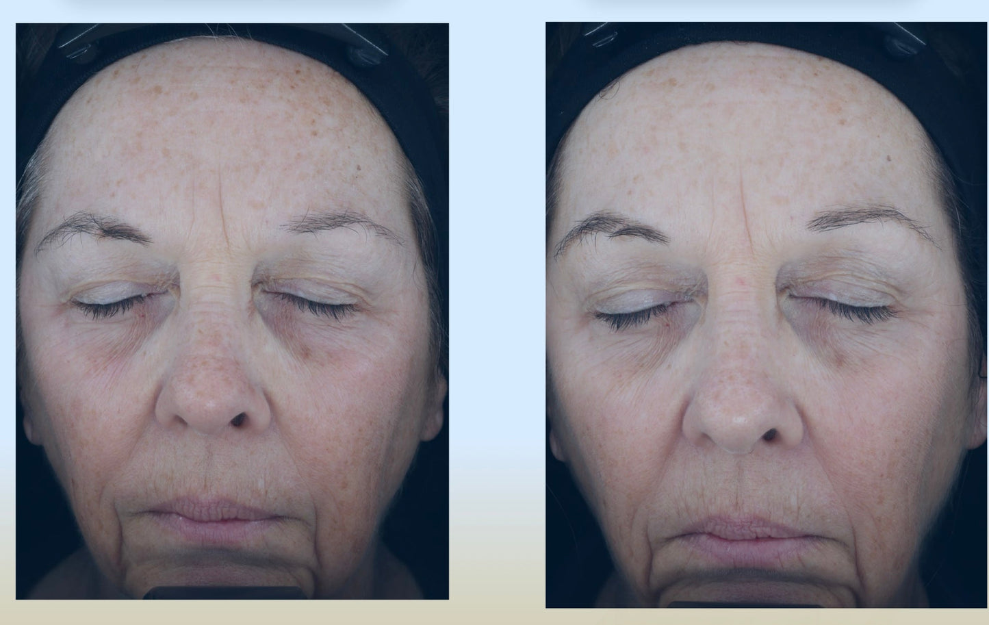 C-RADICAL Defense Antioxidant Serum