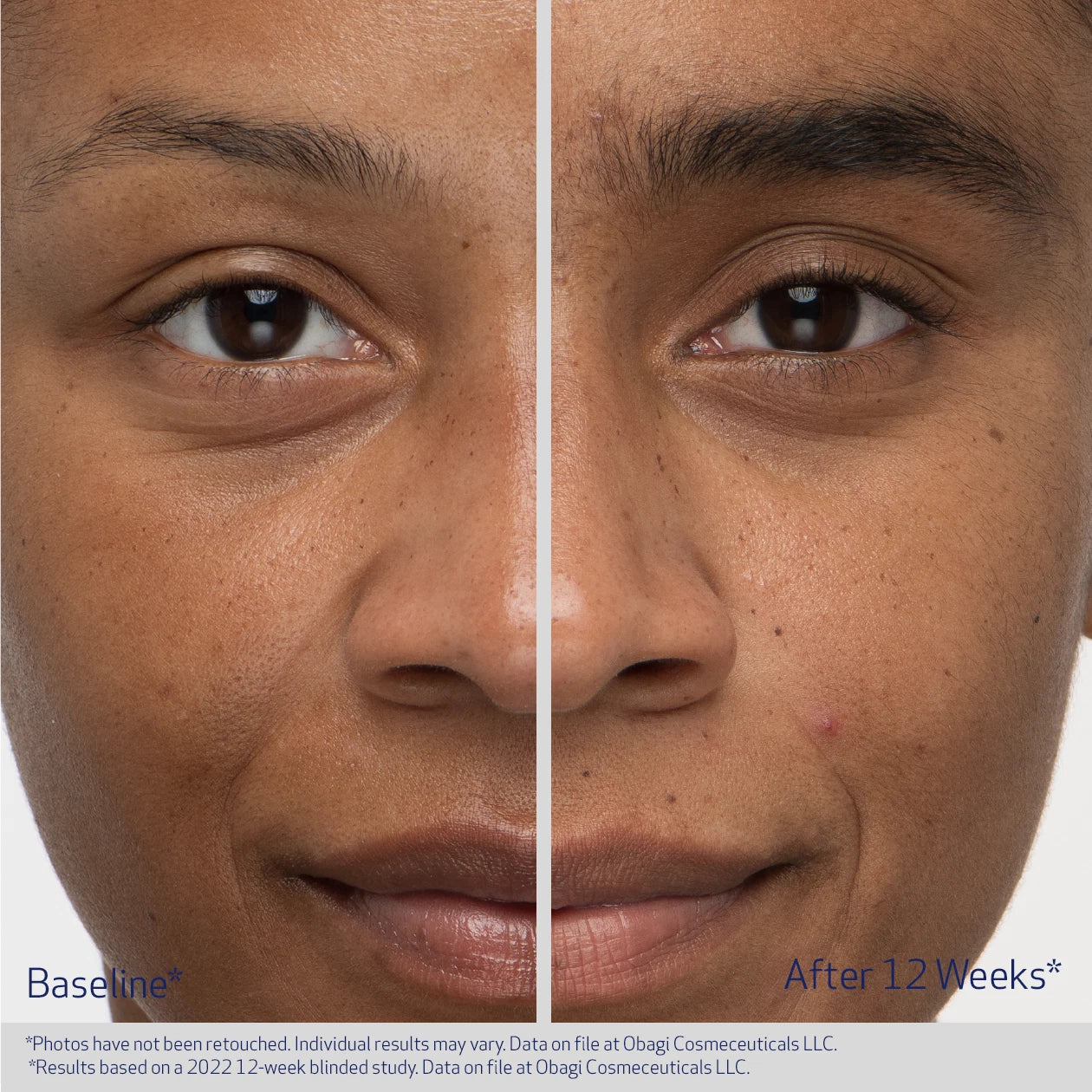 Obagi Nu - Cil Eyebrow Serum