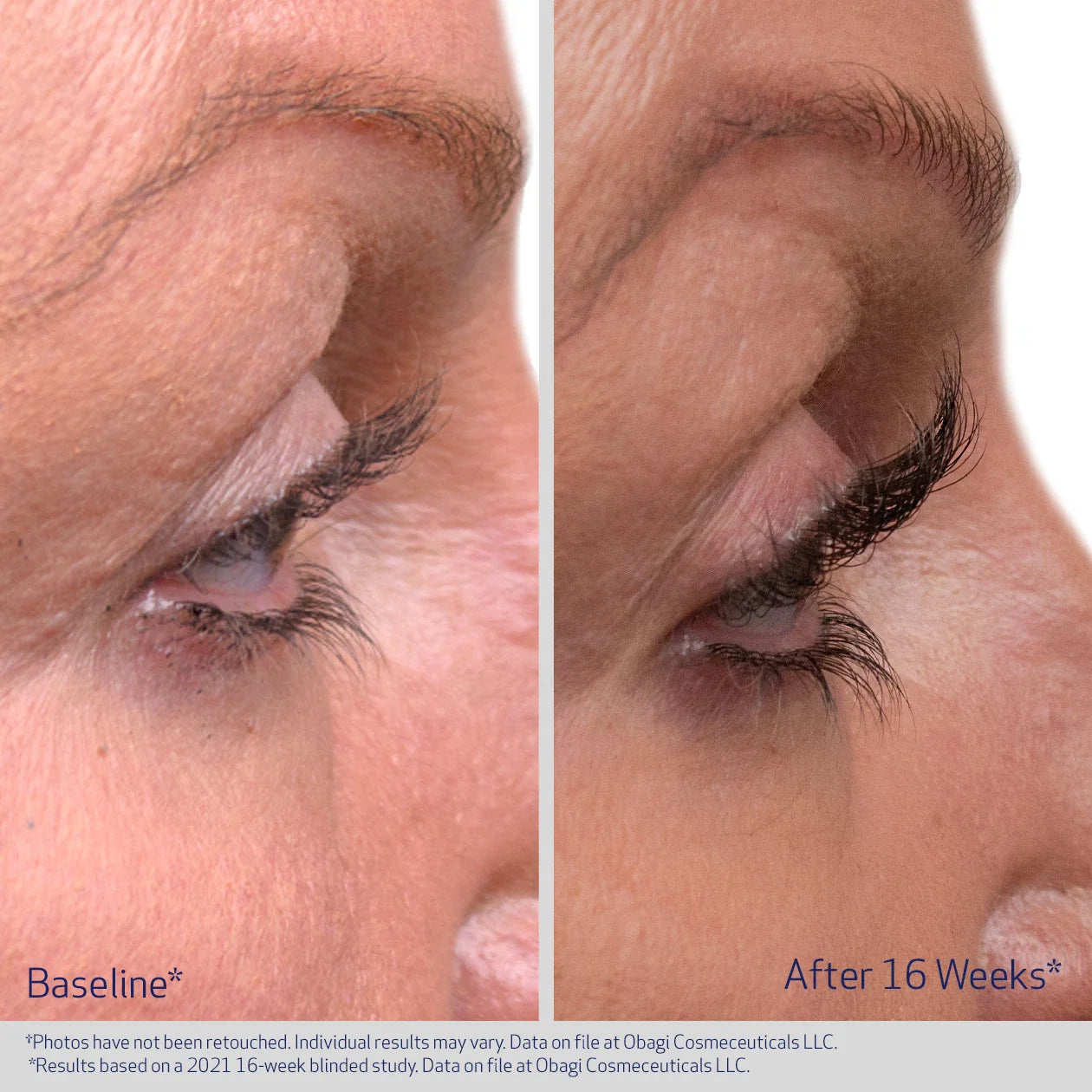 Obagi Nu - Cil Eyelash Serum