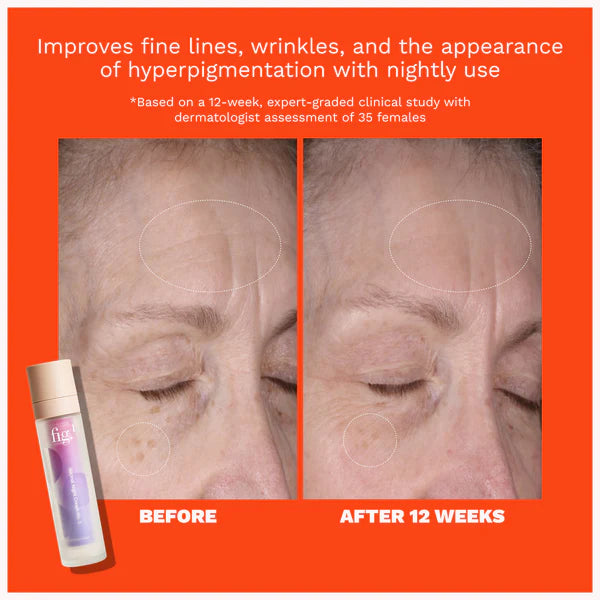 FIG. RETINOL NIGHT CREAM TREATMENT NO.2
