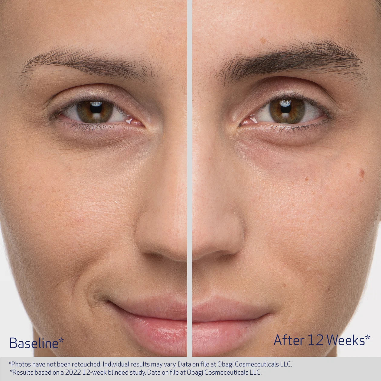 Obagi Nu - Cil Eyebrow Serum