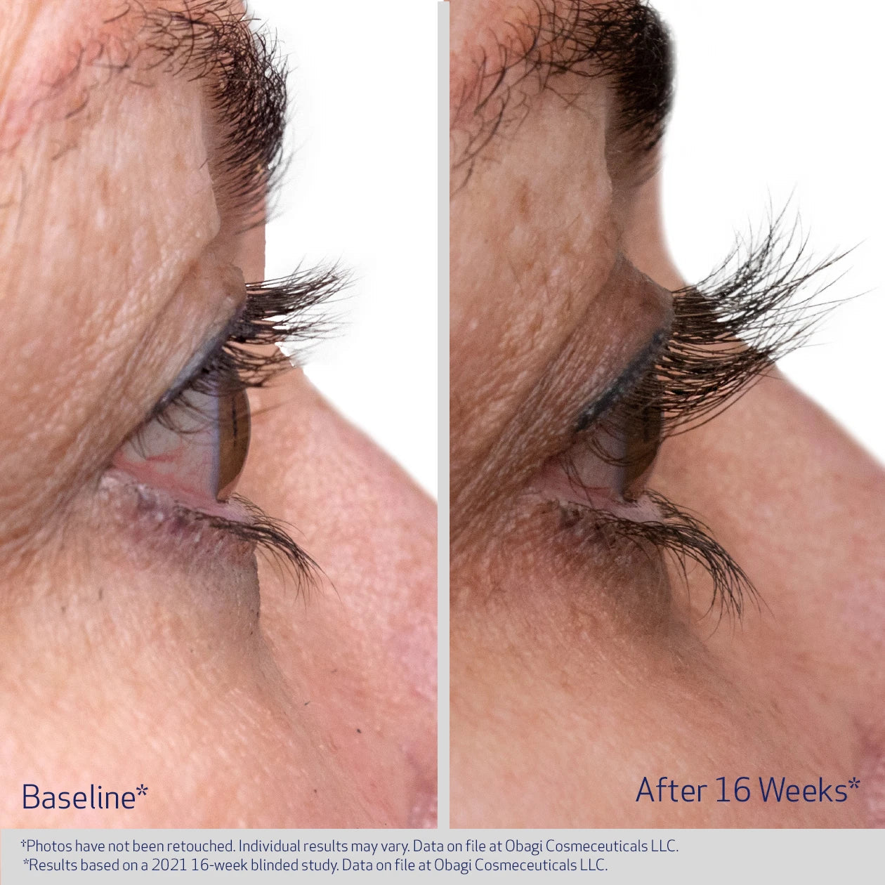 Obagi Nu - Cil Eyelash Serum