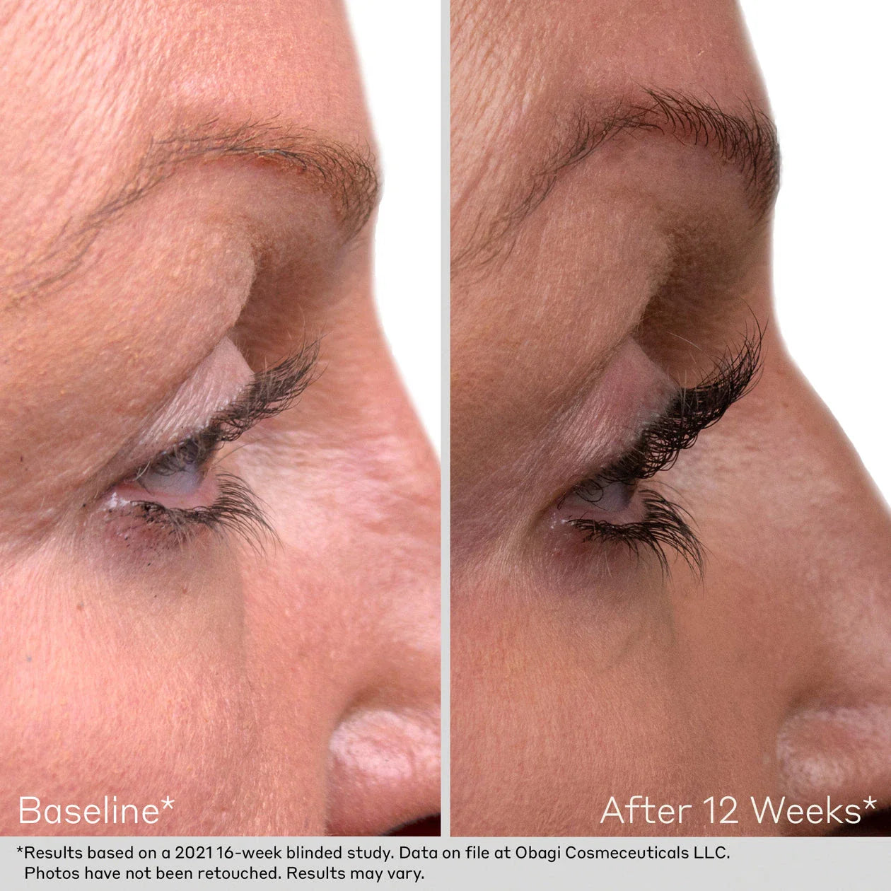 Obagi Nu-Cil Brow/Lash Kit