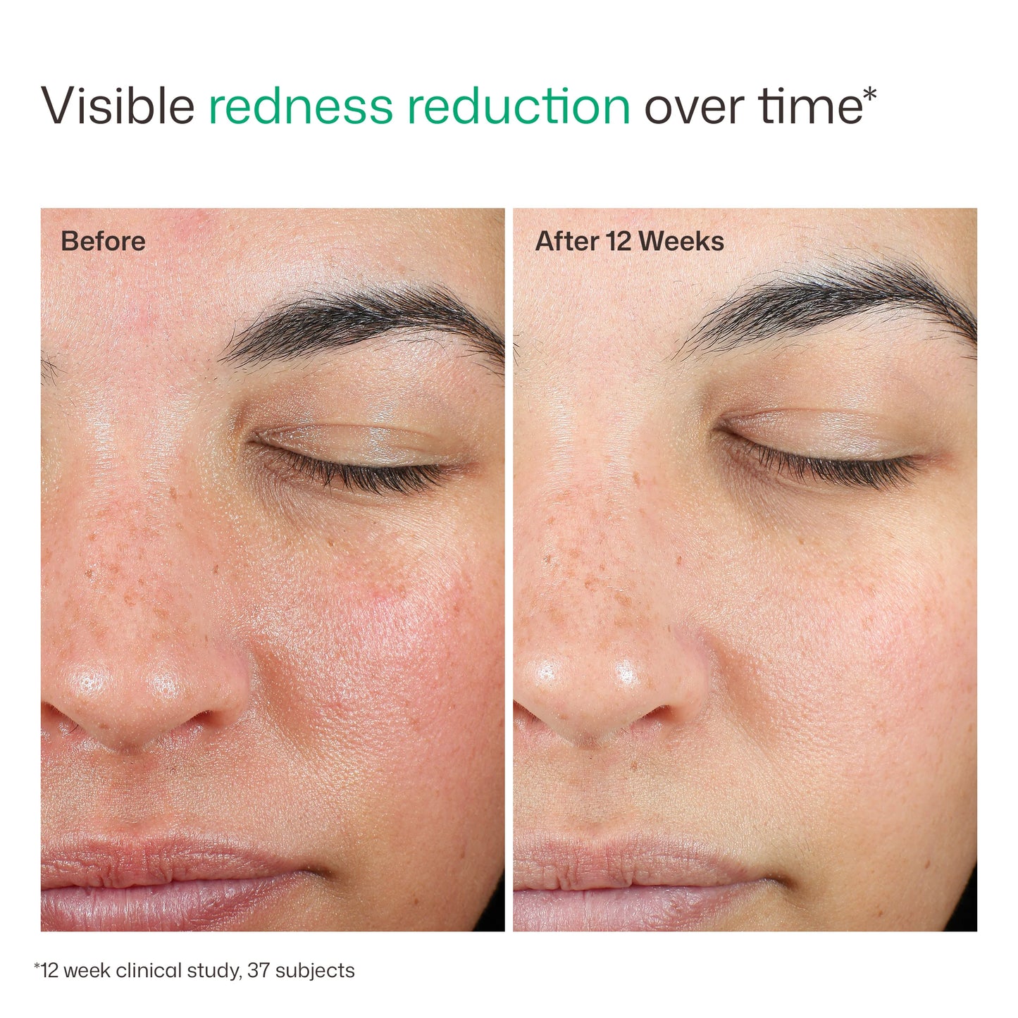 EltaMD UV Skin Recovery Green Tinted Sunscreen
