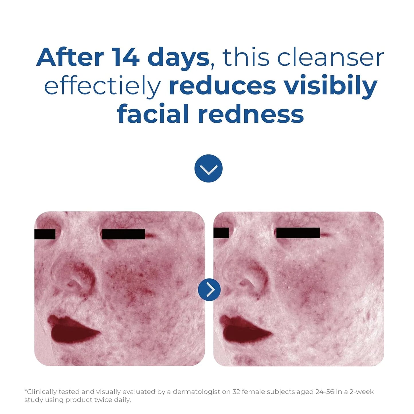 EltaMD Amino Acid Foaming Cleanser