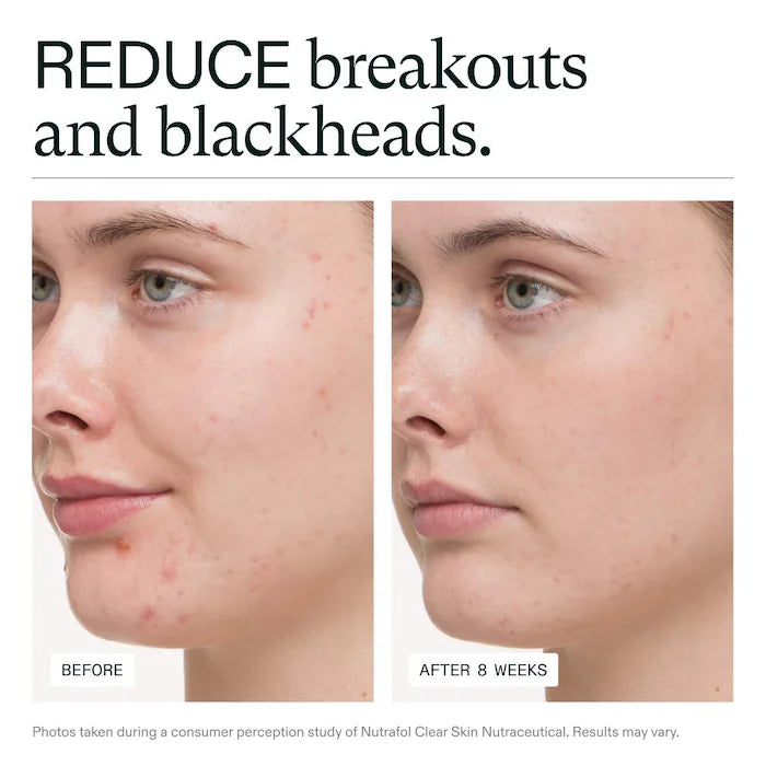 Nutrafol SKIN- Women