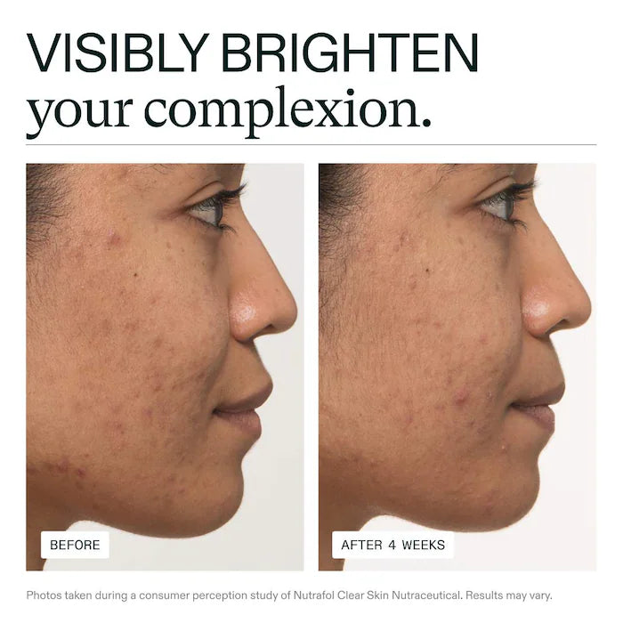 Nutrafol SKIN- Women