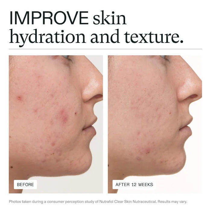 Nutrafol SKIN- Women